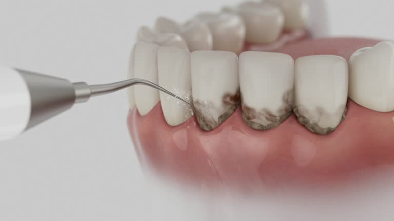 Reliable Dental Implants contractor in Menands, NY by Smile Center Dentistry